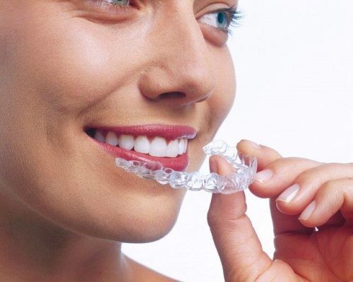 Tannregulering tannlege Majorstua